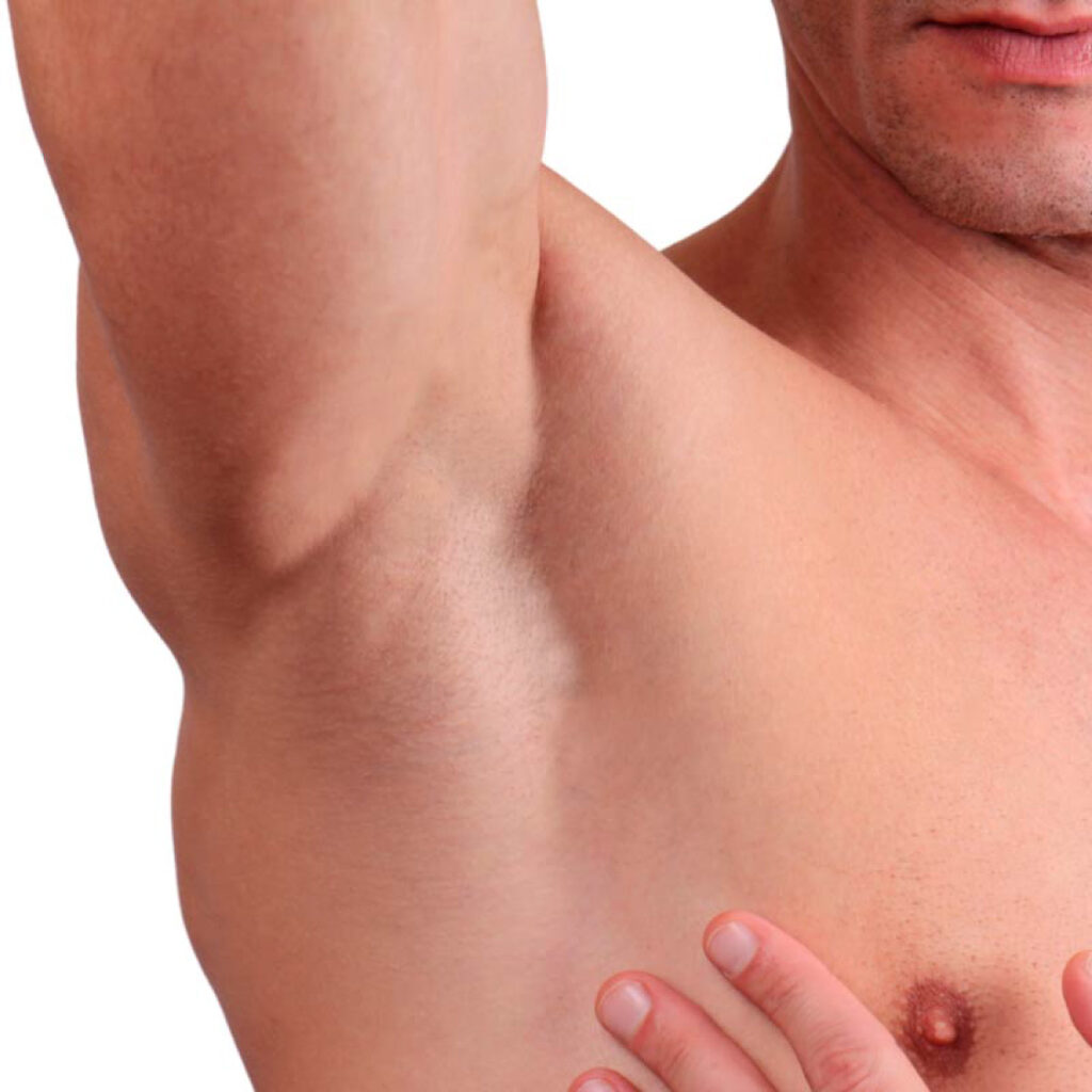 blanqueamiento-hombre