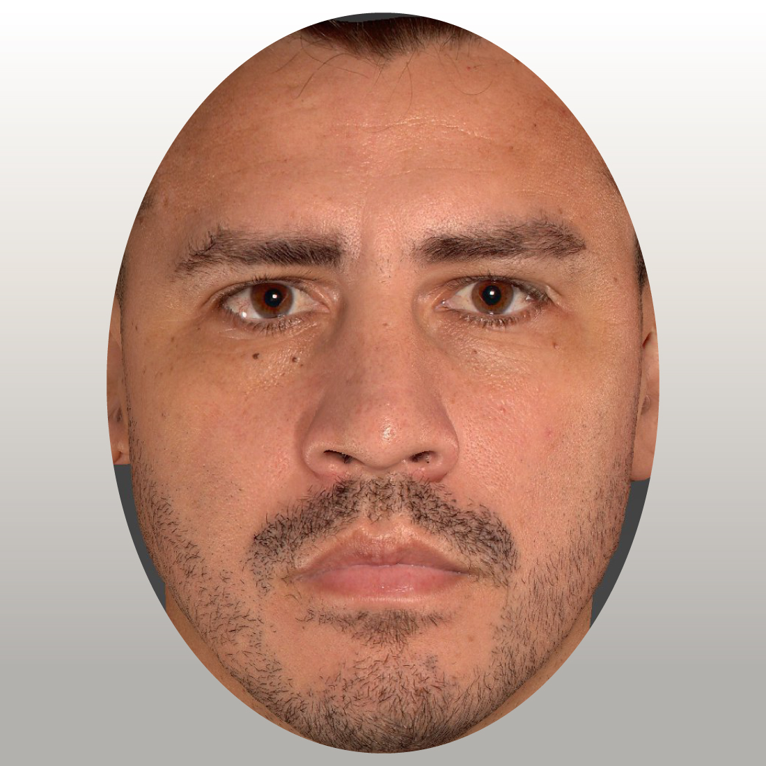 Inyectables de ácido hialurónico