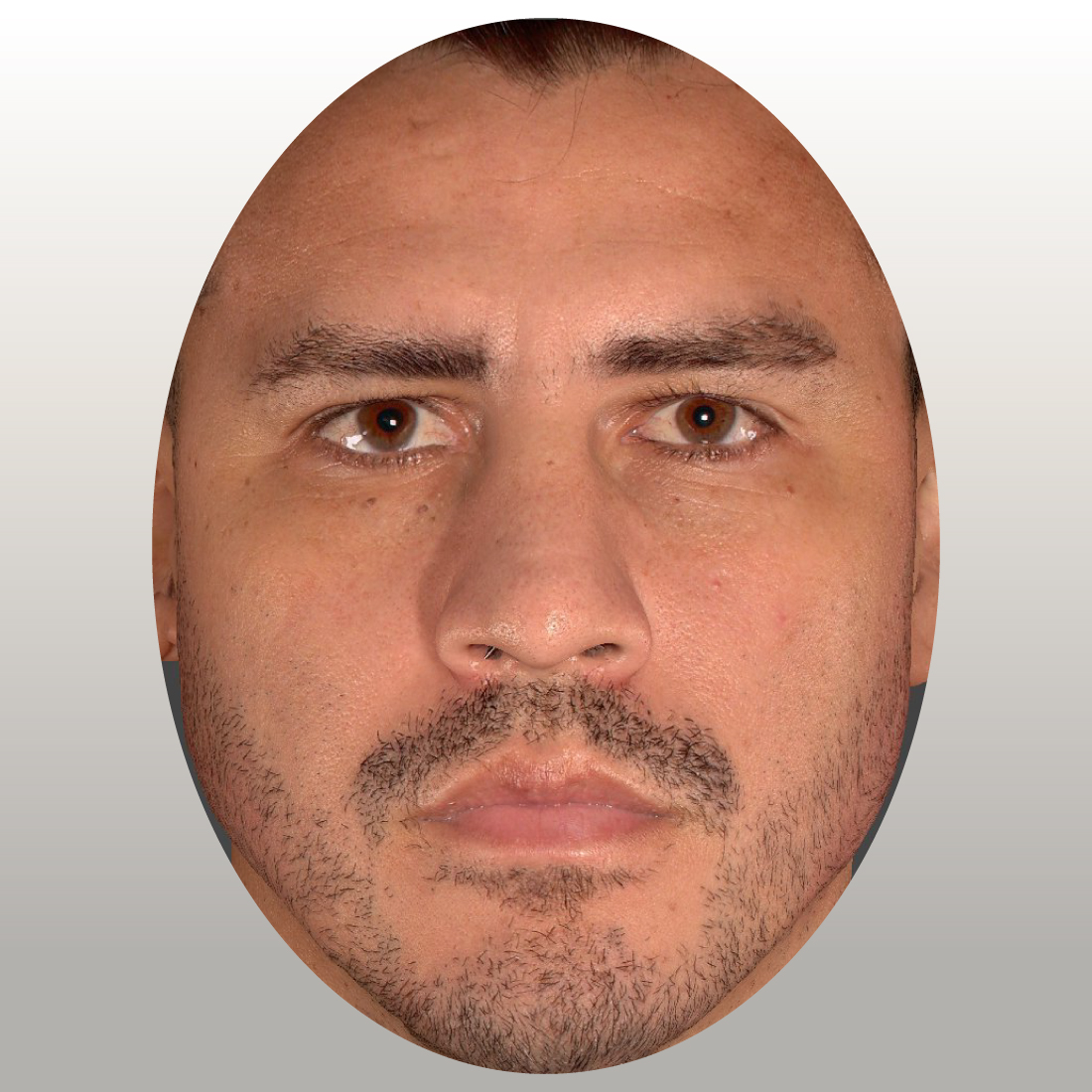 Inyectables de ácido hialurónico