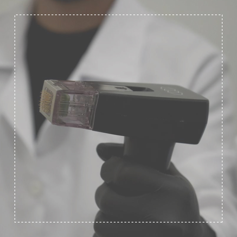 Morpheus8 costa rica