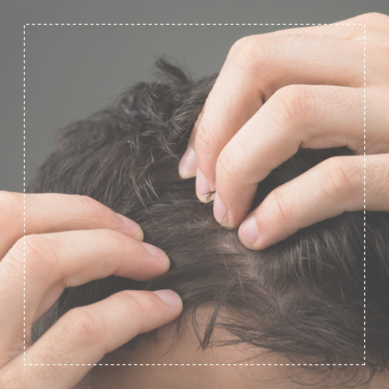 Regenera Rigenera cabello alex rivera