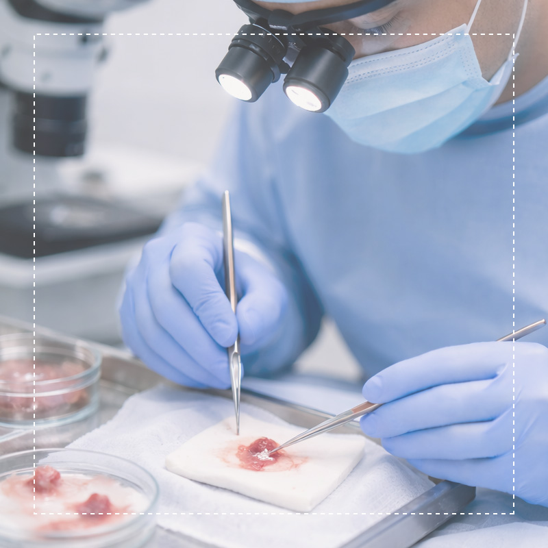 CIRUGÍA DERMATOLÓGICA ESPECIALIZADA MOHS